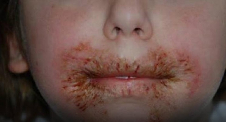 Illustration de l'article : N'utilisez Plus Ces Lingettes Pour Laver Le Visage Des Enfants!