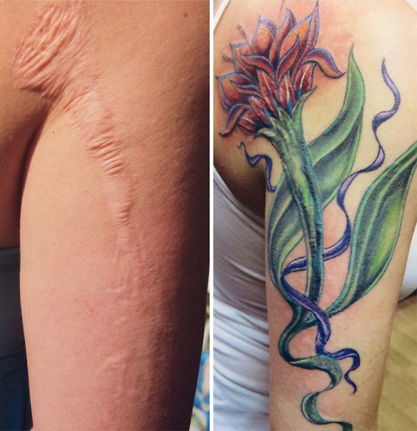 Illustration de l'article : 25 personnes qui ont décidé de transformer d'insupportables cicatrices en oeuvres d'art.