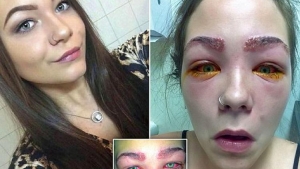 Image illustrant l'article Elle était à deux doigts de finir aveugle à cause d'une pratique que font de plus en plus de femmes !