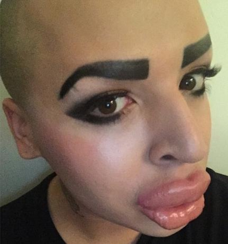 Illustration de l'article : Compl&eacute;tement accro &agrave; Kim Kardashian, il d&eacute;pense 190 000 &euro; pour y ressembler. Le r&eacute;sultat est totalement rat&eacute; !