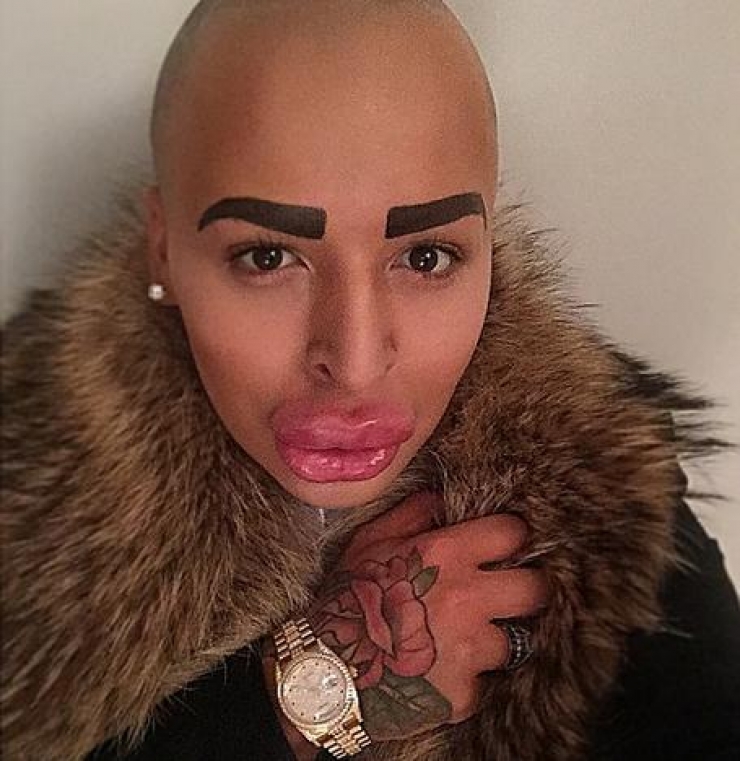 Illustration de l'article : Compl&eacute;tement accro &agrave; Kim Kardashian, il d&eacute;pense 190 000 &euro; pour y ressembler. Le r&eacute;sultat est totalement rat&eacute; !