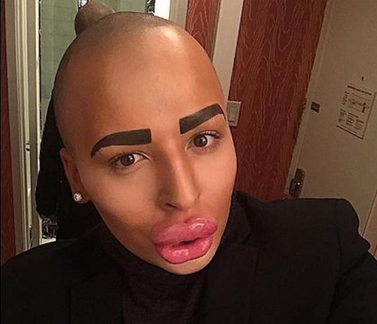 Illustration de l'article : Compl&eacute;tement accro &agrave; Kim Kardashian, il d&eacute;pense 190 000 &euro; pour y ressembler. Le r&eacute;sultat est totalement rat&eacute; !