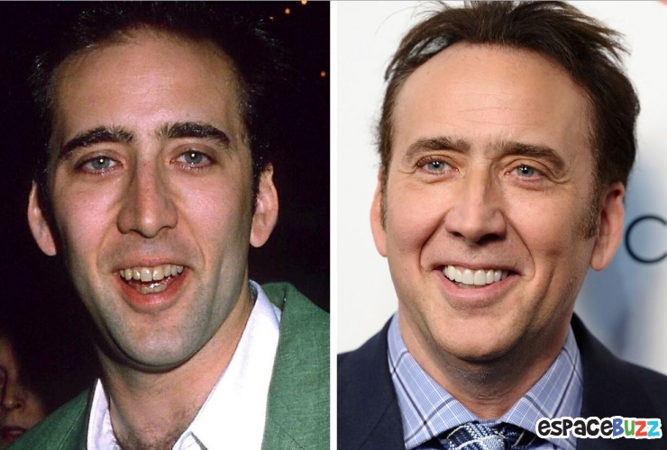 Illustration de l'article : 15 photos de c&eacute;l&eacute;brit&eacute;s avant et apr&egrave;s un bon rabibochage des dents