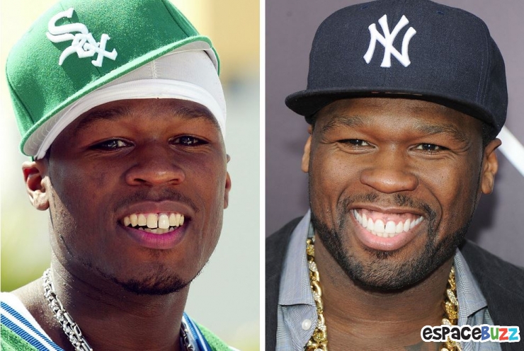 Illustration de l'article : 15 photos de c&eacute;l&eacute;brit&eacute;s avant et apr&egrave;s un bon rabibochage des dents