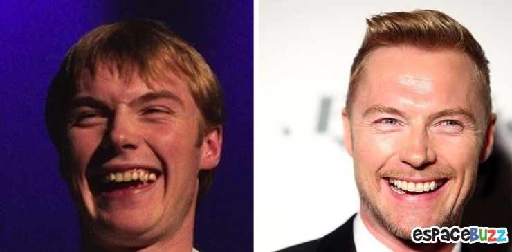 Illustration de l'article : 15 photos de c&eacute;l&eacute;brit&eacute;s avant et apr&egrave;s un bon rabibochage des dents