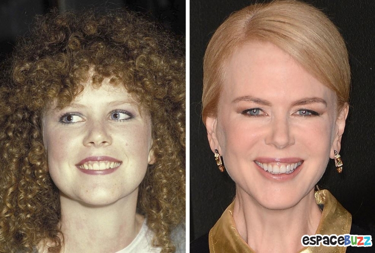 Illustration de l'article : 15 photos de c&eacute;l&eacute;brit&eacute;s avant et apr&egrave;s un bon rabibochage des dents