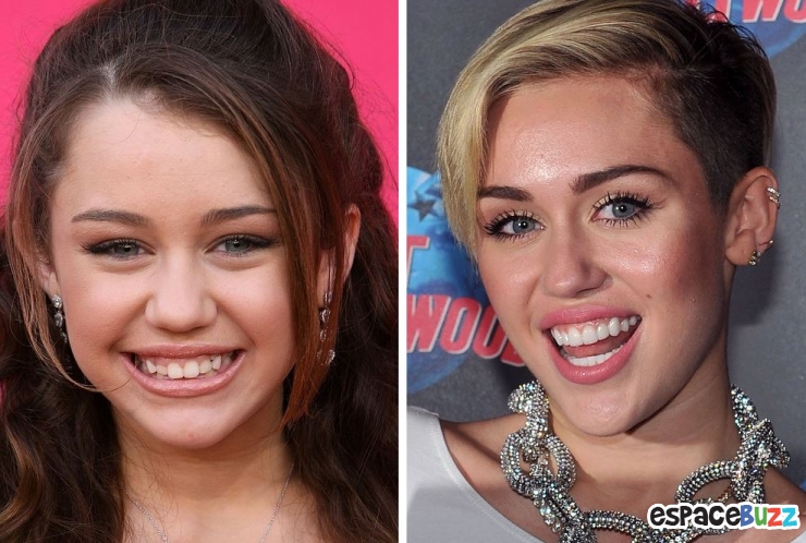 Illustration de l'article : 15 photos de c&eacute;l&eacute;brit&eacute;s avant et apr&egrave;s un bon rabibochage des dents