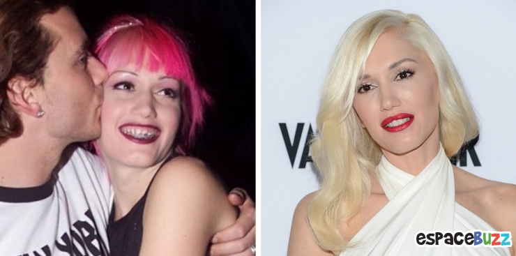 Illustration de l'article : 15 photos de c&eacute;l&eacute;brit&eacute;s avant et apr&egrave;s un bon rabibochage des dents