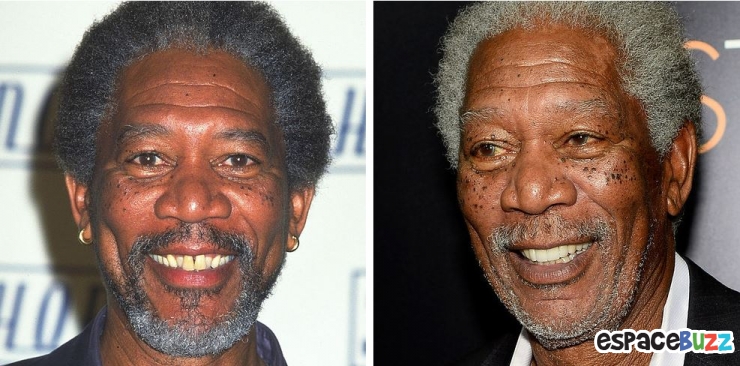 Illustration de l'article : 15 photos de c&eacute;l&eacute;brit&eacute;s avant et apr&egrave;s un bon rabibochage des dents