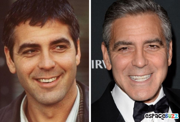 Illustration de l'article : 15 photos de c&eacute;l&eacute;brit&eacute;s avant et apr&egrave;s un bon rabibochage des dents