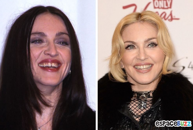 Illustration de l'article : 15 photos de c&eacute;l&eacute;brit&eacute;s avant et apr&egrave;s un bon rabibochage des dents