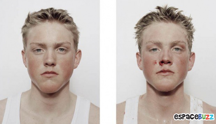 Illustration de l'article : 12 photos de boxeurs avant et apr&egrave;s leur passage sur le ring