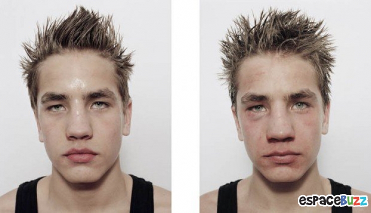 Illustration de l'article : 12 photos de boxeurs avant et apr&egrave;s leur passage sur le ring