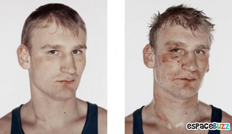 Illustration de l'article : 12 photos de boxeurs avant et apr&egrave;s leur passage sur le ring