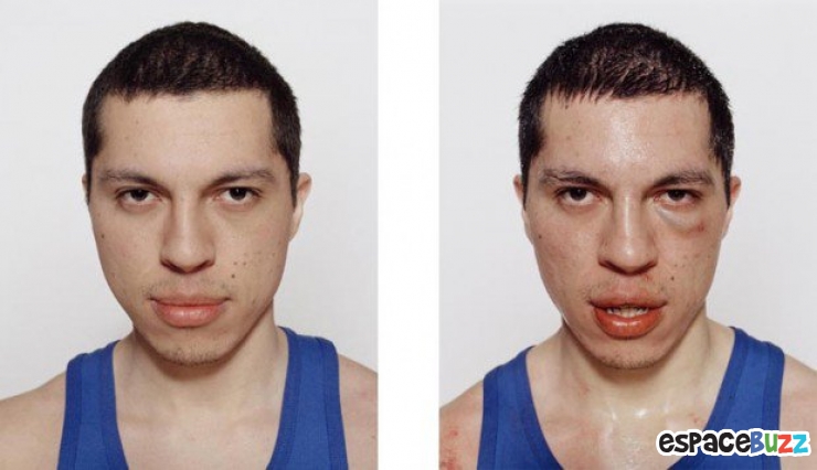 Illustration de l'article : 12 photos de boxeurs avant et apr&egrave;s leur passage sur le ring