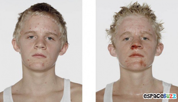 Illustration de l'article : 12 photos de boxeurs avant et apr&egrave;s leur passage sur le ring