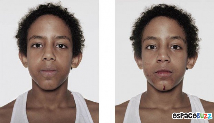 Illustration de l'article : 12 photos de boxeurs avant et apr&egrave;s leur passage sur le ring