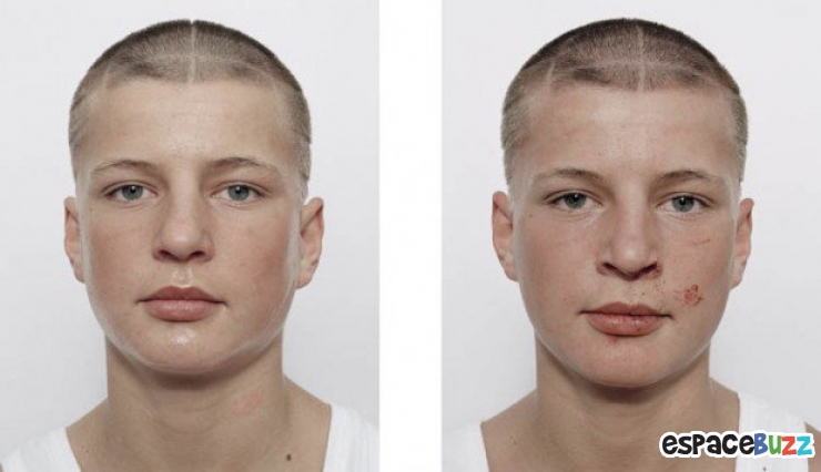 Illustration de l'article : 12 photos de boxeurs avant et apr&egrave;s leur passage sur le ring