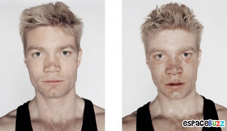 Illustration de l'article : 12 photos de boxeurs avant et apr&egrave;s leur passage sur le ring