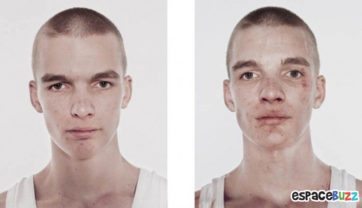 Illustration de l'article : 12 photos de boxeurs avant et apr&egrave;s leur passage sur le ring