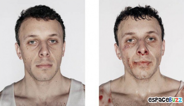 Illustration de l'article : 12 photos de boxeurs avant et apr&egrave;s leur passage sur le ring