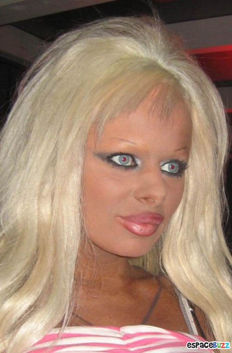 Illustration de l'article : Top 12 des chirurgies esthétiques les plus lamentables !