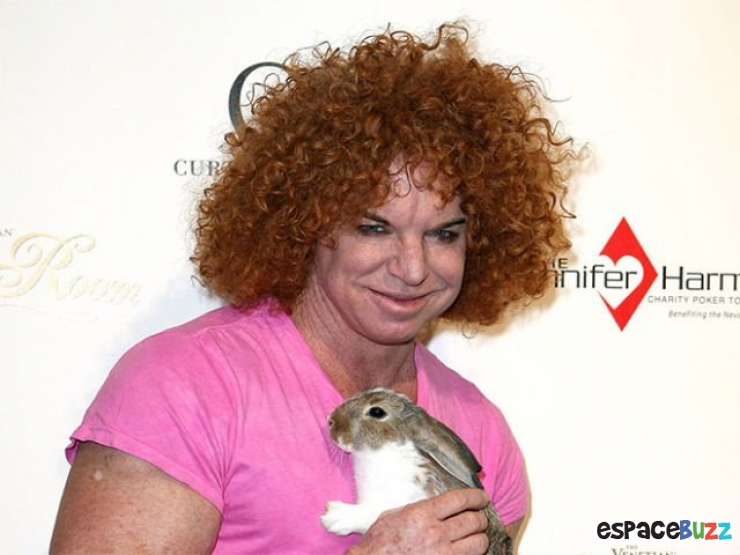 Illustration de l'article : Top 12 des chirurgies esthétiques les plus lamentables !