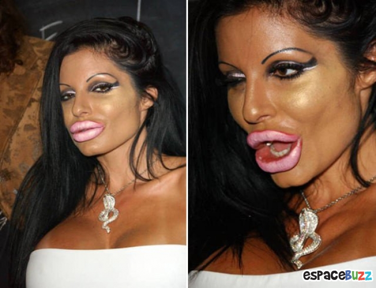 Illustration de l'article : Top 12 des chirurgies esthétiques les plus lamentables !