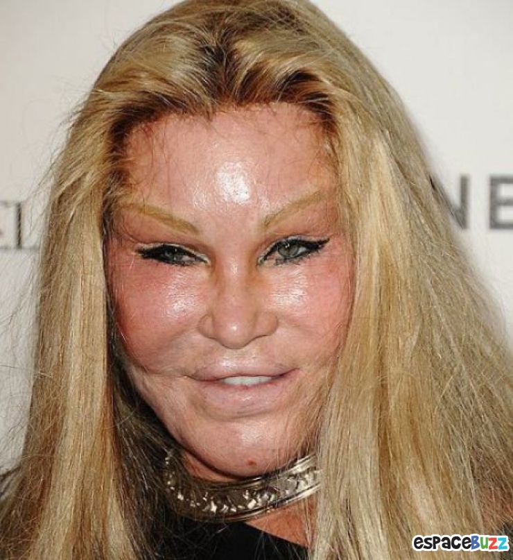 Illustration de l'article : Top 12 des chirurgies esthétiques les plus lamentables !