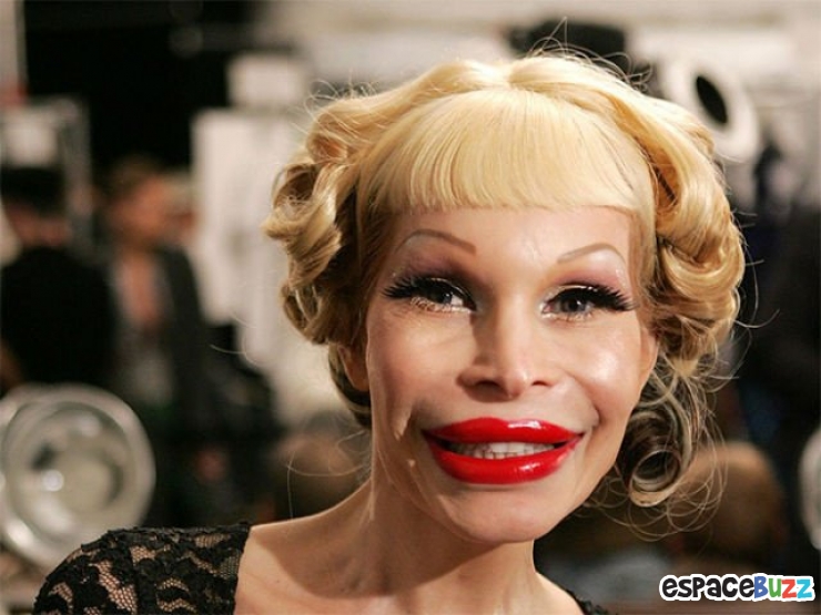 Illustration de l'article : Top 12 des chirurgies esthétiques les plus lamentables !