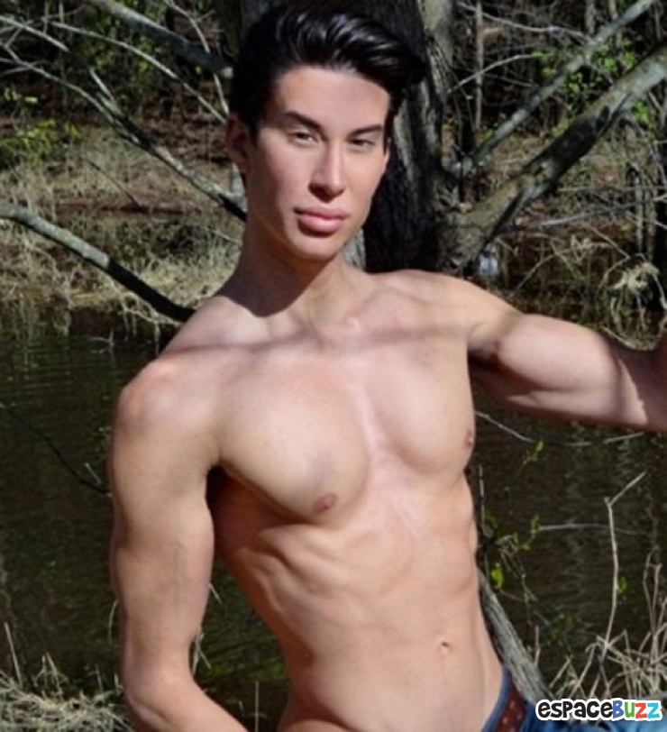 Illustration de l'article : Top 12 des chirurgies esthétiques les plus lamentables !