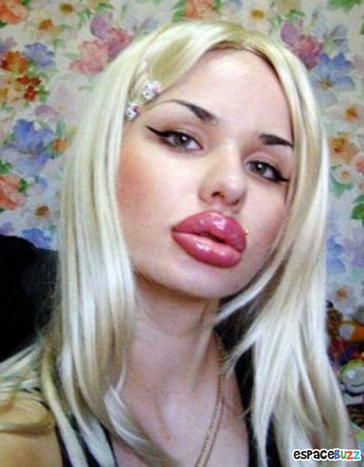 Illustration de l'article : Top 12 des chirurgies esthétiques les plus lamentables !