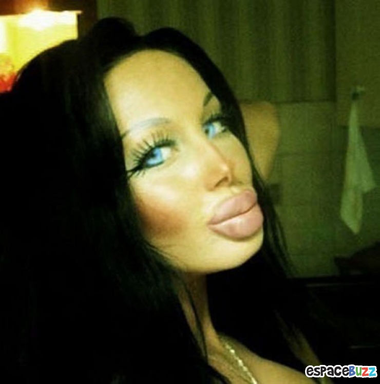 Illustration de l'article : Top 12 des chirurgies esthétiques les plus lamentables !