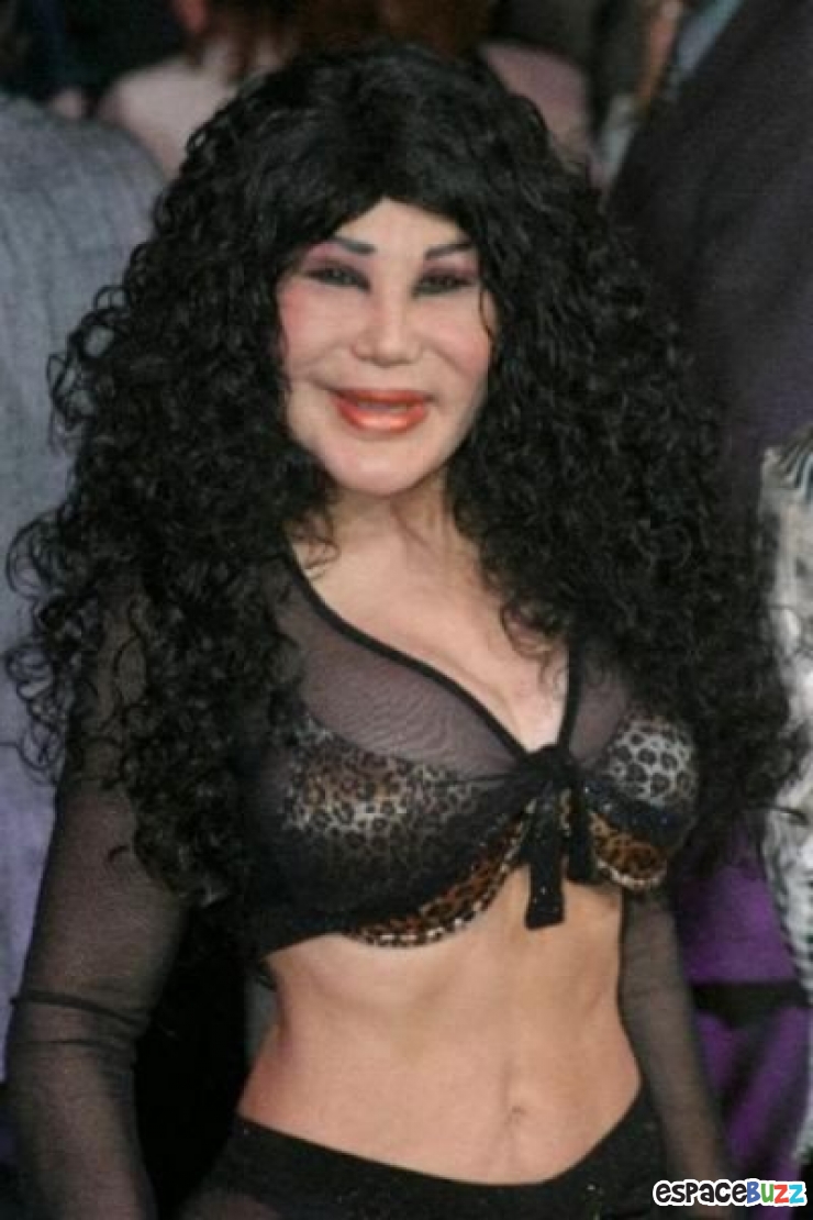 Illustration de l'article : Top 12 des chirurgies esthétiques les plus lamentables !