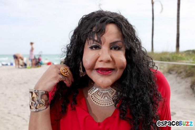 Illustration de l'article : Top 12 des chirurgies esthétiques les plus lamentables !