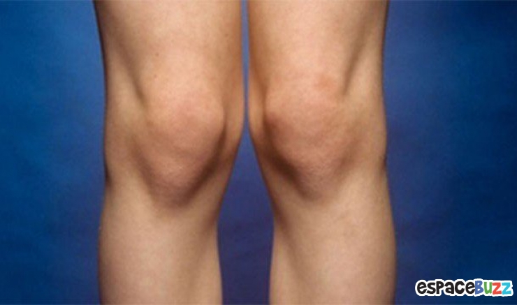 Illustration de l'article : Top 12 des phobies les plus surprenantes!