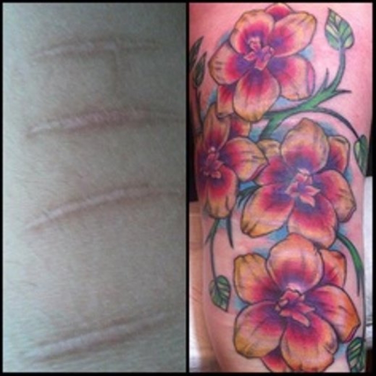 Illustration de l'article : 16 tatouages masquant les blessures du passé