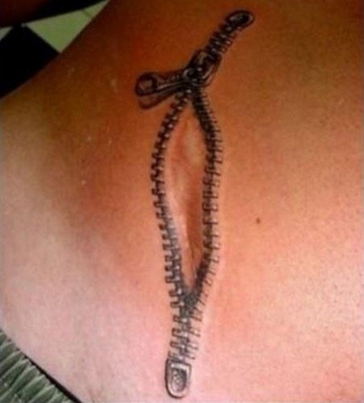 Illustration de l'article : 16 tatouages masquant les blessures du passé