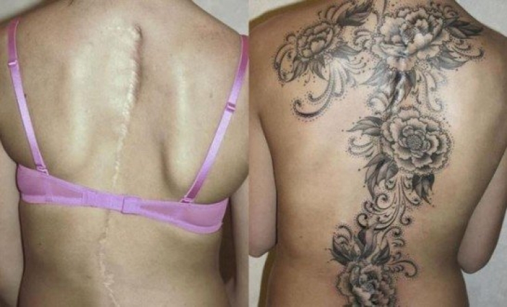 Illustration de l'article : 16 tatouages masquant les blessures du passé