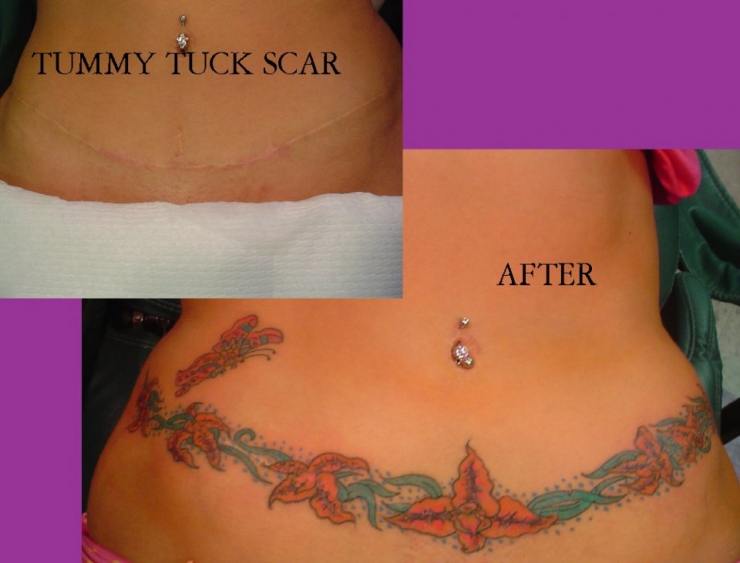 Illustration de l'article : 16 tatouages masquant les blessures du passé