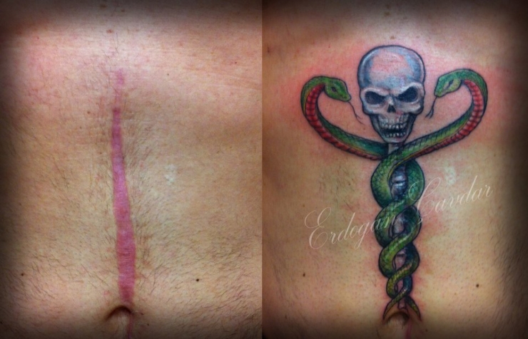 Illustration de l'article : 16 tatouages masquant les blessures du passé