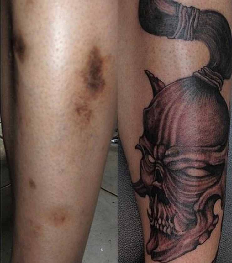 Illustration de l'article : 16 tatouages masquant les blessures du passé
