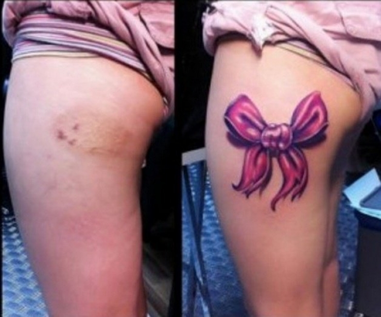 Illustration de l'article : 16 tatouages masquant les blessures du passé