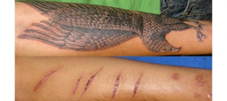 Illustration de l'article : 16 tatouages masquant les blessures du passé