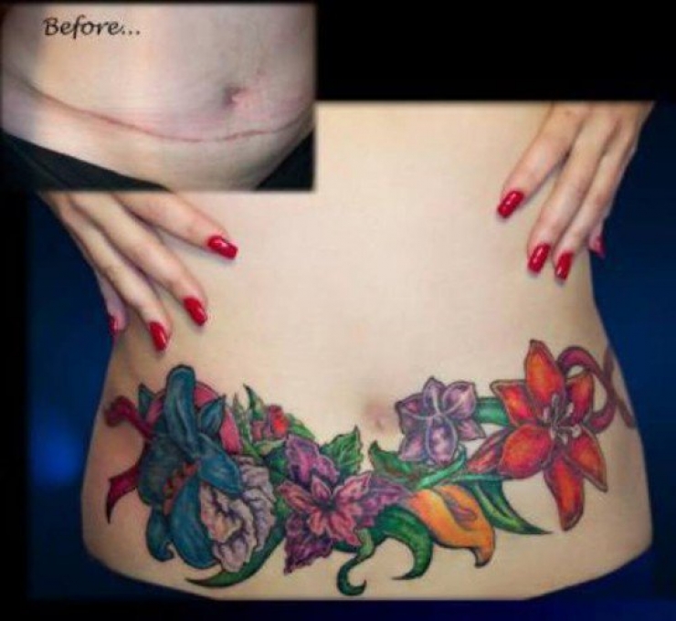 Illustration de l'article : 16 tatouages masquant les blessures du passé