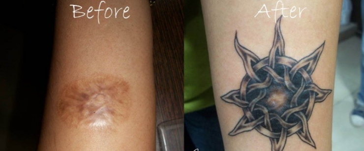 Illustration de l'article : 16 tatouages masquant les blessures du passé