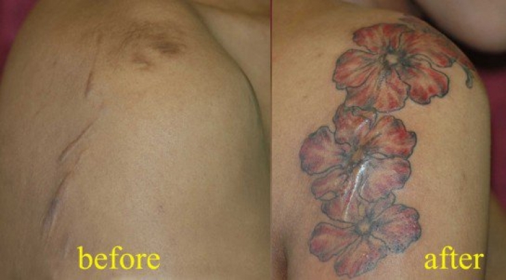 Illustration de l'article : 16 tatouages masquant les blessures du passé