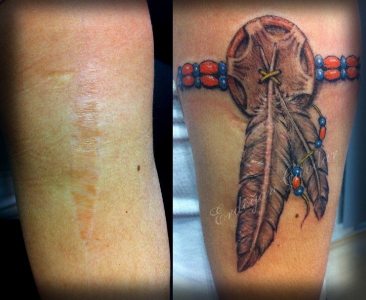 Illustration de l'article : 16 tatouages masquant les blessures du passé