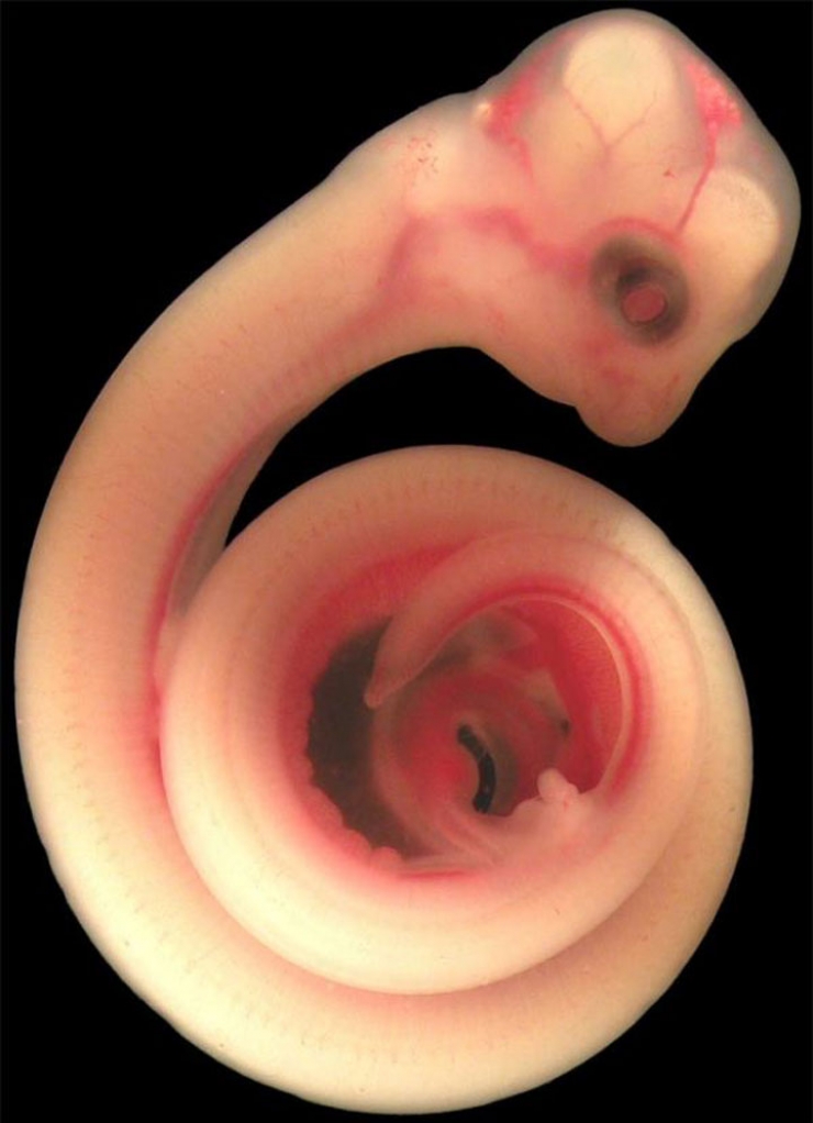 Illustration de l'article : 11 images incroyables de foetus d'animaux