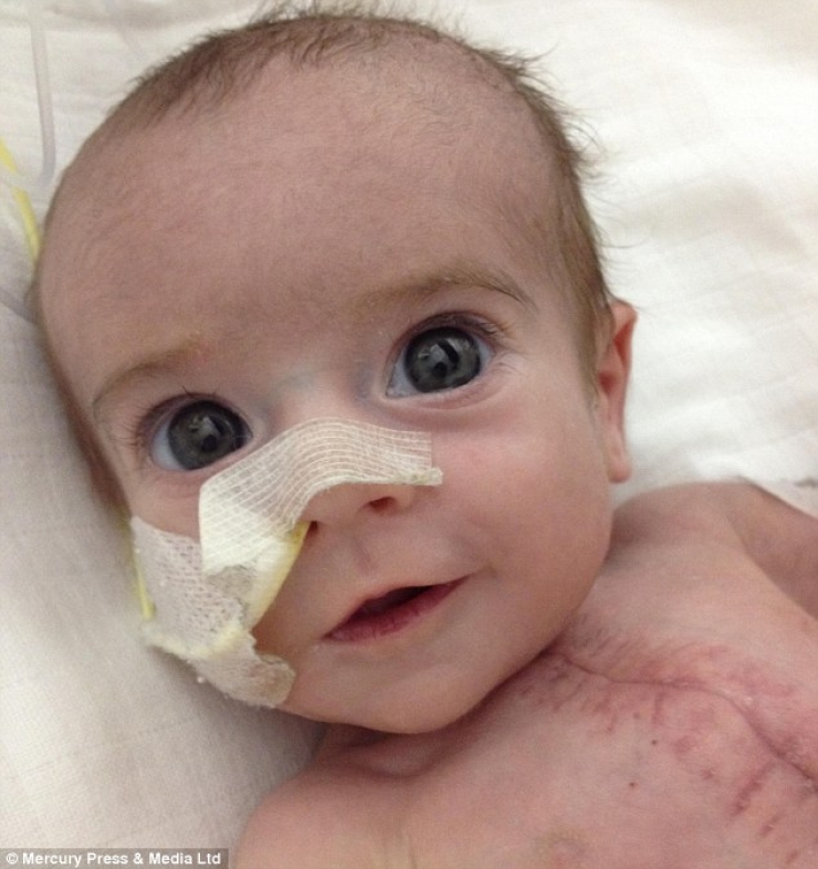 Illustration de l'article : N&eacute; avec la moiti&eacute; d'un coeur, ce b&eacute;b&eacute; n'aurait pas du rester en vie... C'est un vrai miracle !